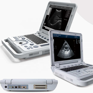 Ecógrafo Portátil Plegable con Múltiples Sondas <span class=keywords><strong>Doppler</strong></span> Médicas para Hospitales, Clínicas Veterinarias y Granjas Ganaderas, Pedidos al por Mayor - Product Image 3