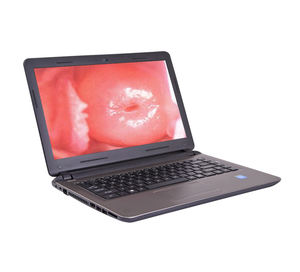 Videocolposcopio Vaginal Médico, Videocolposcopio Digital, Colposcopio Portátil, Colposcopio Ginecológico para Examen - Product Image 5