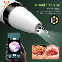 Instrument de nettoyage des dents visuelles à ultrasons nettoyage dissolvant de pierre de tartre instrument de beauté dentaire à domicile nettoyeur de dents électrique