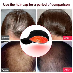Suyzeko topi terapi <span class=keywords><strong>Laser</strong></span> <span class=keywords><strong>Level</strong></span> rendah, peralatan terapi fisik, topi terapi pertumbuhan rambut, topi <span class=keywords><strong>Laser</strong></span> <span class=keywords><strong>Level</strong></span> rendah, lampu merah 200 Diode 650nm - Product Image 5