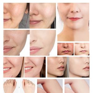 Crème éclaircissante et blanchissante puissante pour une peau naturellement éclatante, 100 ml, vente en gros à faible MOQ - Product Image 5