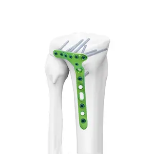 Placa de Implante para Trauma con Bloqueo <span class=keywords><strong>Proximal</strong></span>, Distal, Lateral, Humeral, Radiáculo, Única, Femoral y Tibial - Product Image 1