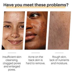 Savon Éclat au Curcuma 65g*2 Marque Privée OEM Kojic Citron Anti-Taches Sombres Végétalien - Product Image 5