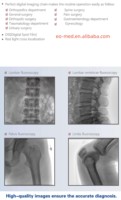 Machine Mobile de radiographie à rayons X, haute qualité et à bas prix, intensificateur d'image numérique, système FPD c-arm CMX-118F