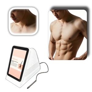 <span class=keywords><strong>Appareil</strong></span> médical clinique de précision à intervention minimale <span class=keywords><strong>pour</strong></span> l'épilation permanente des poils fins du visage en salon - Product Image 4