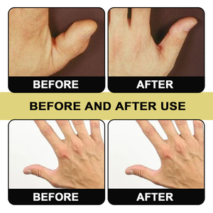 Cerotto Anti-Artrite per Pollice South Moon, Cerotto Traspirante per il Sollievo dal Dolore Articolare, Cerotti Non Tessuti per la Cura di Dita, Pollice e Polso - Product Image 4