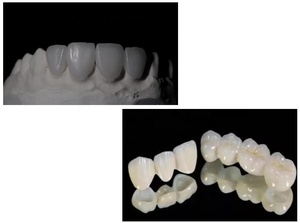 مختبر الأسنان Sinterizacion مع واي فاي وفرن تلبد بجهاز تحكم عن بعد لحرق سريع وبطيء - Product Image 6