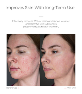 Nouveau design rose beauté robinet purificateur couche de filtre supprimer le chlore résiduel Mini robinet filtre beauté filtre pour salle de bain - Product Image 6