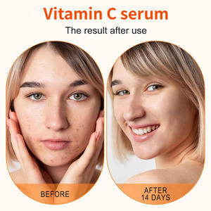 Hot Selling Organic Collagen Anti Wrinkle Centella Asiatica Repairing Nicotinamide Bleaching Vitamin C Face Whitening Serum - Product Image 2