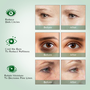 Parches <span class=keywords><strong>de</strong></span> colágeno Natural Oragnic para las arrugas <span class=keywords><strong>de</strong></span> <span class=keywords><strong>los</strong></span> <span class=keywords><strong>ojos</strong></span>, parches coreanos para las ojeras - Product Image 5