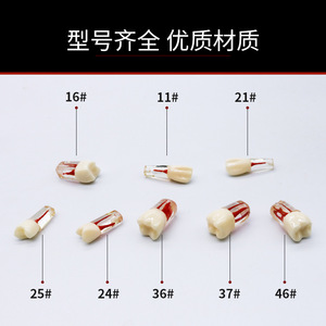 Modelo Dental de Práctica N.° 16 #   Resina con cámara de pulpa para entrenamiento en terapia oral - Product Image 2