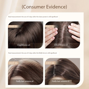 Shampooing antipelliculaire au sélénium sulfide pour soins capillaires, nettoyage en profondeur, vente en gros OEM - Product Image 5
