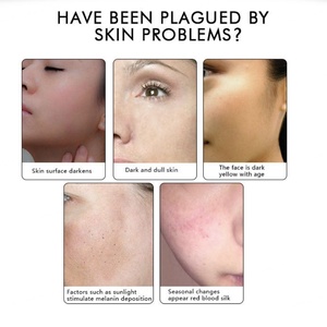 Halal Cosmetics Private Label Skin Care Dark Spot Remover Anti-aging Anti-wrinkle Whitening Niacinamide <b>Face</b> Serum - Product Image 4