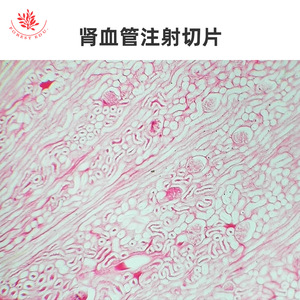 Microestructura típica de las pruebas de microscopio del sistema circulatorio, que incluyen venas grandes, arterias grandes y vasos renales después de la coloración HE. - Product Image 2