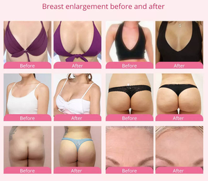 Appareil portable d'agrandissement mammaire par ventouses, drainage lymphatique et massage, équipement de beauté pour salon et spa - Product Image 5