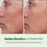 Produits de soin de la peau naturels en marque privée, sérum facial réparateur et apaisant à la Centella Asiatica, PDRN, Bifida Ferment Filtrate