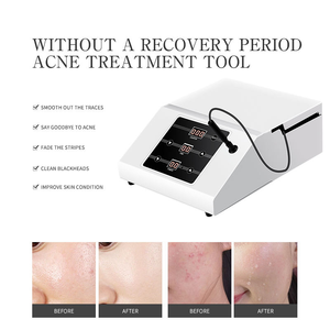 Equipo de Belleza Facial de Última Generación 2025 para Uso Doméstico, Exfoliante para el Acné, Eliminación de Puntos Negros, Enchufes US/ZA/CN 1 - Product Image 2