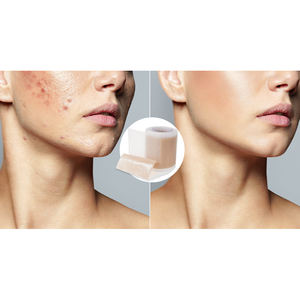 כיתה רפואית מתקדמת צלקת סיליקון צלולה משם יריעות טיפול ברצועות למניעת קלואיד שרף - Product Image 6