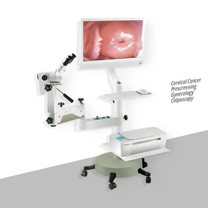 Kernel Binoculaire Colposcoop Hoge Resolutie Ccd Camera Beeldvormingssysteem Colposcopie Geïntegreerde Mobiele Trolley - Product Image 3