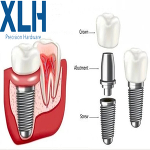 Transfert en titane droit-<span class=keywords><strong>Abutment</strong></span> pour Hex interne RP 3.5 OEM ODM personnaliser la taille - Product Image 2