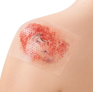 Feuille de gel de silicone Yafho, silicone <span class=keywords><strong>double</strong></span> face pour la surface de la <span class=keywords><strong>peau</strong></span>, 7,5*10 cm, dispositif médical OEM - Product Image 3