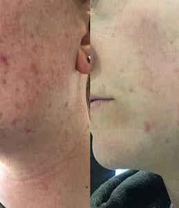 Gant exfoliant en soie 100% soie turque exfoliant en profondeur épurateur corporel élimination de la peau morte exfoliant pour le corps lisse la peau - Product Image 6