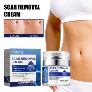 <span class=keywords><strong>Crema</strong></span> Reparadora de Cicatrices EELHOE, Hidratante y Suavizante de la Piel con <span class=keywords><strong>Aloe</strong></span> <span class=keywords><strong>Vera</strong></span>, Desvanece Cicatrices de <span class=keywords><strong>Embarazo</strong></span> y Quirúrgicas, Antiarrugas para el Cuerpo de la Mujer - Product Image 2