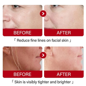 Crème Visage Bio Raffermissante Efficace au Rétinol de Marque Blanche <span class=keywords><strong>avec</strong></span> 3,5% de Rétinol Actif Anti-Âge - Product Image 6