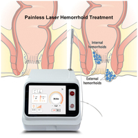 Traitement des hémorroïdes, traitement des hémorroïdes, machine laser endolaser pour hémorroïdes 980 1470 nm