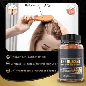 Gomitas Bloqueadoras de DHT OEM con 10000mcg de Biotina y Saw Palmetto <span class=keywords><strong>para</strong></span> <span class=keywords><strong>el</strong></span> Crecimiento <span class=keywords><strong>del</strong></span> <span class=keywords><strong>Cabello</strong></span>, <span class=keywords><strong>Suplemento</strong></span> <span class=keywords><strong>para</strong></span> <span class=keywords><strong>el</strong></span> Bienestar Masculino - Product Image 3