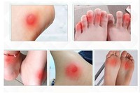 Pansements hydrocolloïdes avancés pour le soin des ampoules et des talons, best-seller, pour la prévention et le traitement, imperméables, forte adhérence, CE