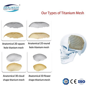 Malla de Titanio Médica para Injertos Óseos, Malla de Titanio Craneal Ortopédica con Forma de Nube Anatómica 3D para Cirugía Craneal - Product Image 4