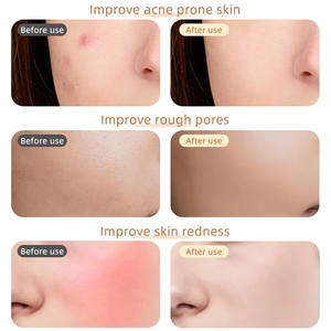 2026 <b>Hot</b> LED Face Skin Care 7 Color Light Modes Rechargeable Beauty Glow Instrument Portable Facial Device LED Face Mask - Product Image 2