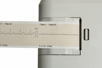 Contec — Machine ECG Portable avec écran couleur, 100g, moniteur ECG, électrocardiographe à une canal, 12 têtes