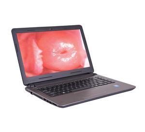 पोर्टेबल हैंडहेल्ड मेडिकल एचडी स्त्रीरोग वीडियो कोलोपोस्कोप महिला इलेक्ट्रॉनिक वीडियो कोलोपोस्कोप - Product Image 3