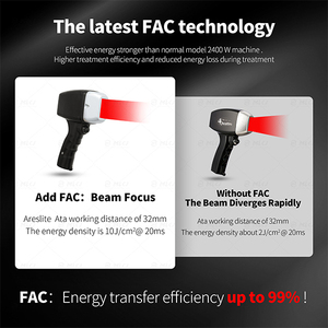 Máy triệt lông laser diode 808nm nâng cấp 1200w 1600w 3000w, máy triệt lông laser 755/940/1064/808 4 bước sóng diode - Product Image 4