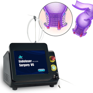 Eliminación Efectiva de Hemorroides, Tratamiento Láser de Alta Potencia 980+1470nm, Dispositivos Quirúrgicos para Hemorroides Externas - Product Image 5