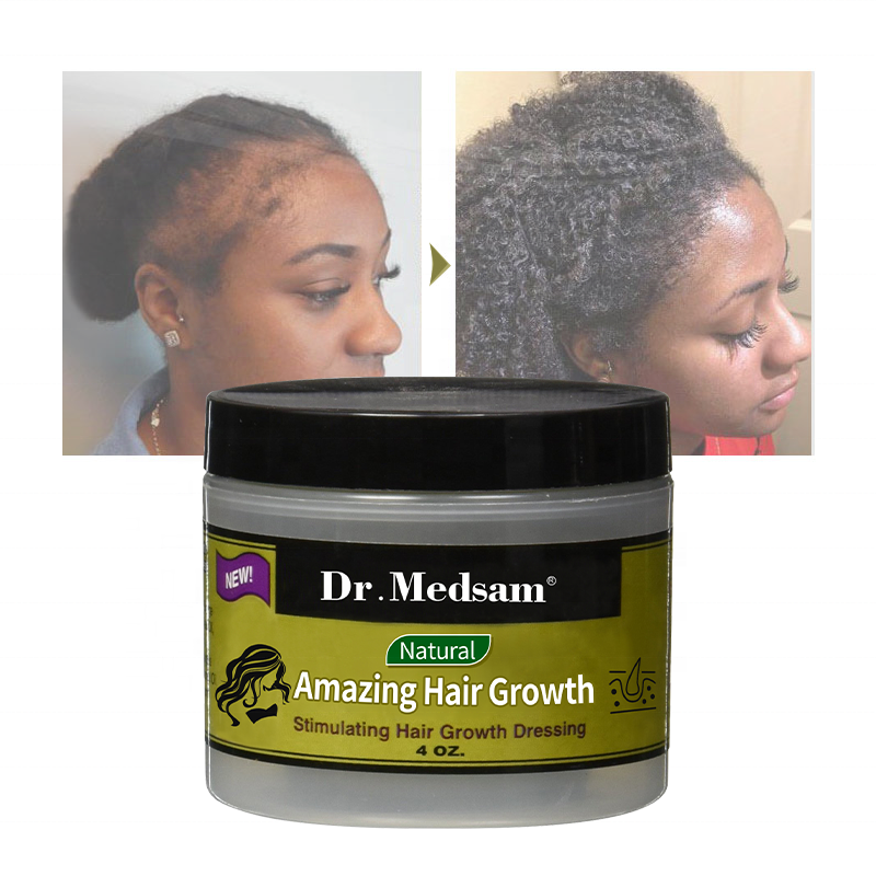 Amazing Stimulating Hair Growth Dressing Hair Treatment Products Prevent Hair Loss Cream Set