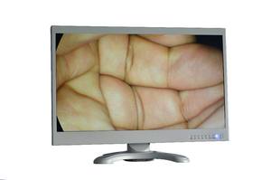 電動<span class=keywords><strong>HD</strong></span>医療用内視鏡モニター-22/24/27/32/55インチ臨床グレードクラスII（腹腔鏡検査、胸腔鏡検査用） - Product Image 4