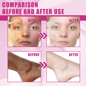 गहरे त्वचा की शक्ति पीले छीलने तेल मजबूत छीलने तेल त्वचा को मॉइस्चराइजिंग निशान प्रभावी छीलने वाला तेल साफ करता है - Product Image 6