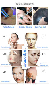 Láser Nd Yag Q-Switched al por mayor 1064nm 532nm 1320nm para eliminación de tatuajes de cejas para salones de belleza - Product Image 4