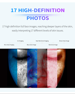 Nuevo Diseño, Analizador de Piel Avanzado con Espejo, Sistema Analizador de Piel Facial, Precio Económico, Tipo 3D, Analizador de Piel con IA, Escáner Facial - Product Image 6