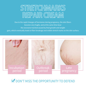 Crema Eficaz para la Eliminación de Cicatrices y la Reparación de Estrías con Colágeno y Ácido Hialurónico para Suavizar, Reafirmar y Combatir las Arrugas del Cuerpo - Product Image 3