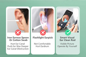 <span class=keywords><strong>Xlife</strong></span> X1 Smart Ohrenschmalz entfernungs maschine WiFi Otoskop und Visual Ear Cleaner Endoskop-Technologie - Product Image 5