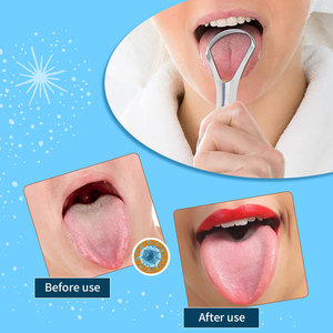 Factory Professional Custom 2pcs Kit Baby Tongue Cleaner Soft <span class=keywords><strong>Dental</strong></span> Oral Care Tool raschietto per lingua per adulti e bambini - Product Image 4