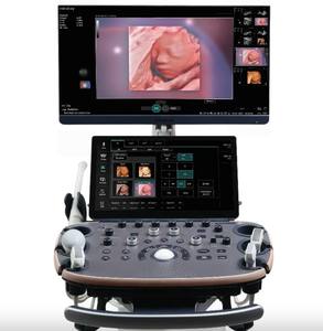 Mindray Imagyn I9 Full HD Diagnostisch Echografie Systeem Kleuren <span class=keywords><strong>Doppler</strong></span> Echografie Apparaat met 4 Transducer Probes - Product Image 3