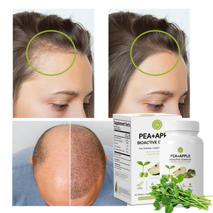 Suplemento Energético Herbal al por Mayor con Biotina de Alta Potencia Contra la Caída del Cabello - Product Image 5