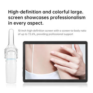 Colposcopio Digital HD Sunbright S-10U para Examen Ginecológico, Colposcopio Vaginal Portátil - Product Image 4