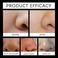 Bandes de nettoyage des pores en plastique noires pour l'élimination des points noirs, nettoyant doux pour le visage contre la saleté et les impuretés, rétrécit les pores, patchs hydratants pour le nez