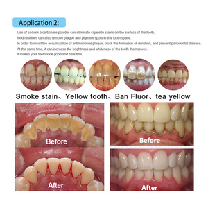 Sabbia blaster ortodontico aria profia <span class=keywords><strong>unit</strong></span>à ossido di alluminio sandblaster macchina forniture mediche per apparecchiature di laboratorio odontoiatrico - Product Image 2